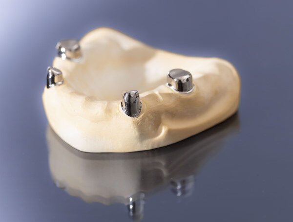 Ein Gipsmodell mit 4 Teleskopen