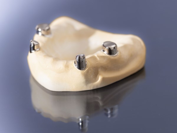 Ein Gipsmodell mit 4 Teleskopen